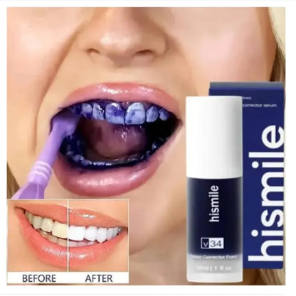 Hismile Teeth Whitening Serum